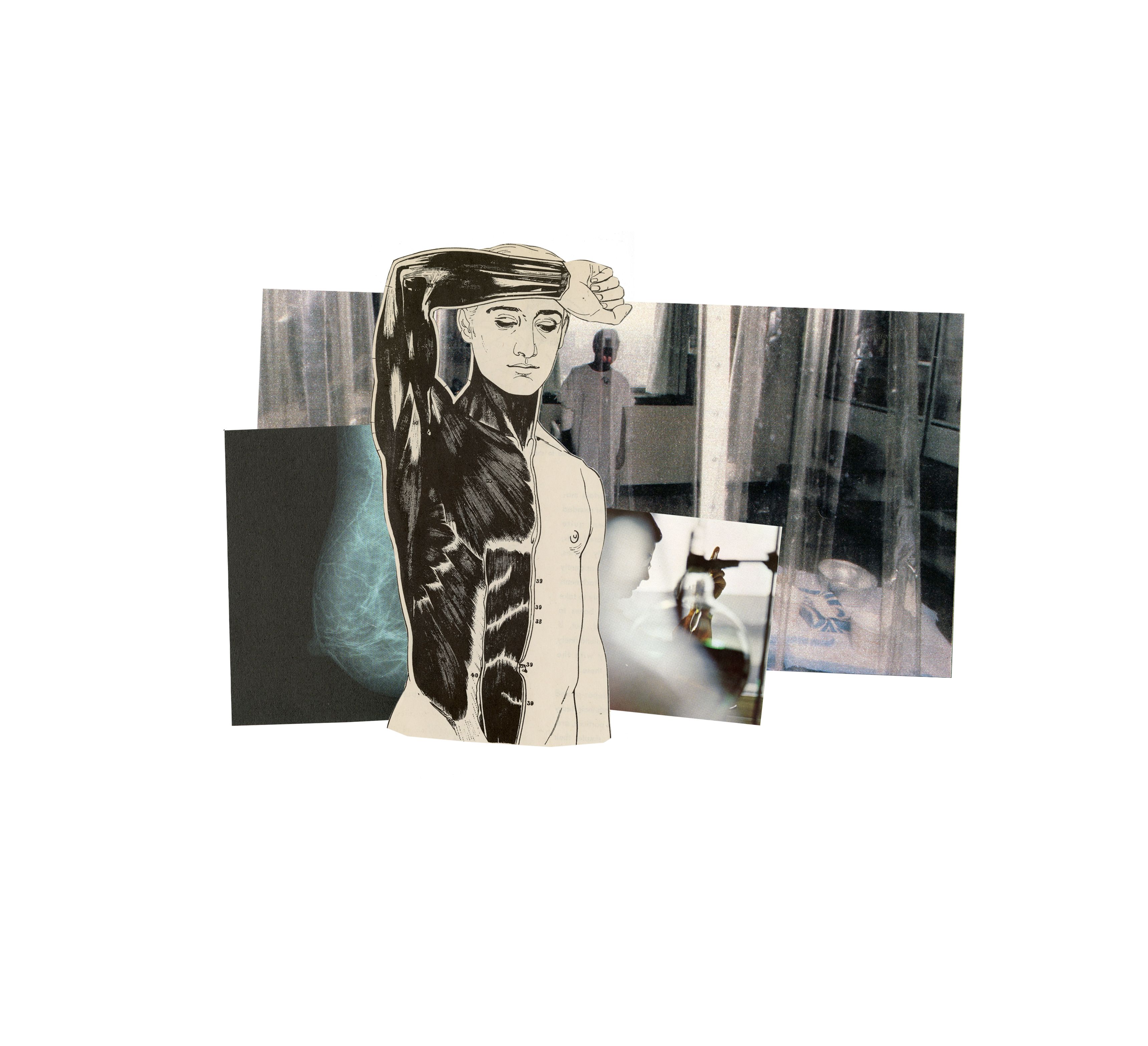 Trans people need breast cancer screenings, too